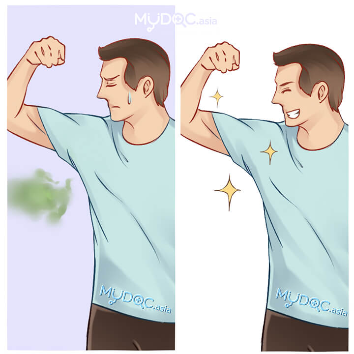 Body Odour Treatment
