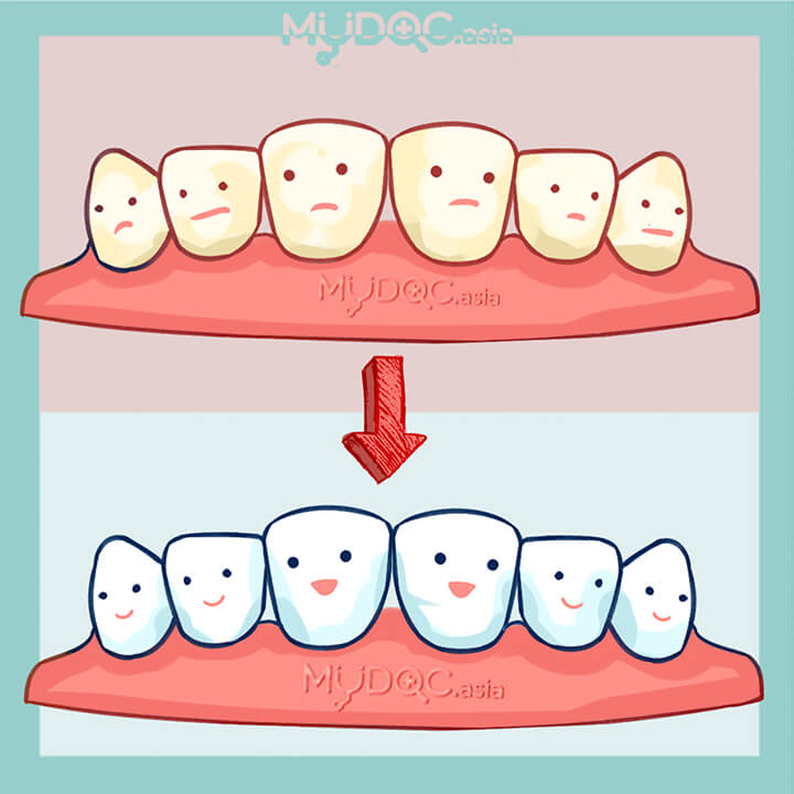 Cosmetic Dentist Consultation 
