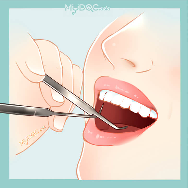 Dental Checkup