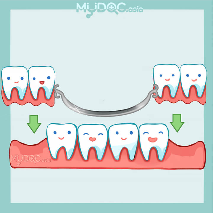Denturist Consultation