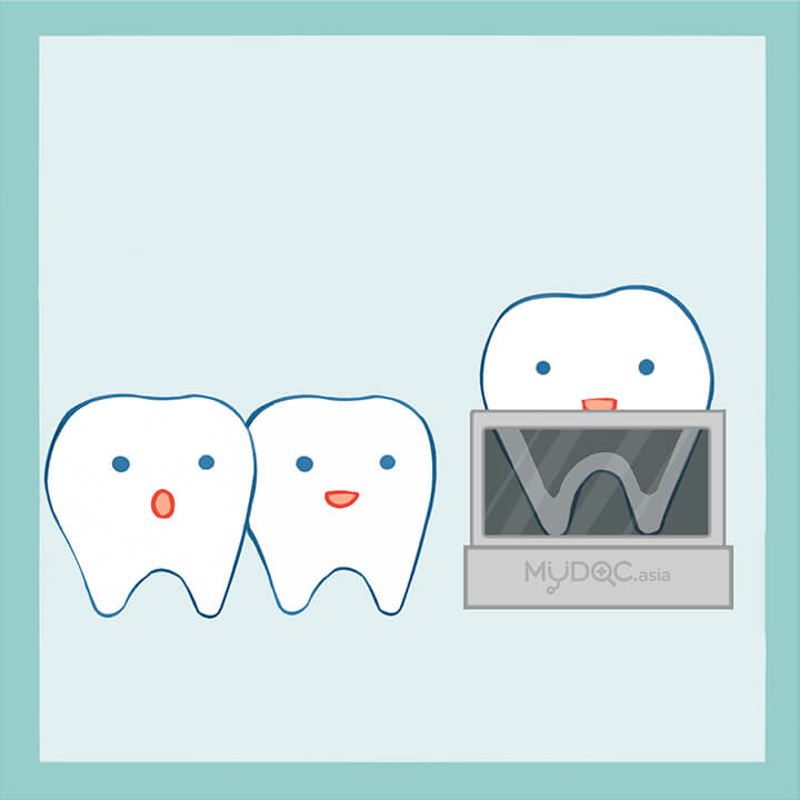 Digital Panoramic Dental X-Ray