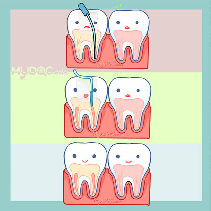 Endodontist Consultation