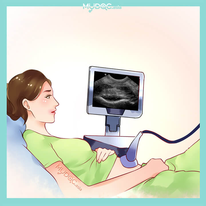 Gynaecological Ultrasound
