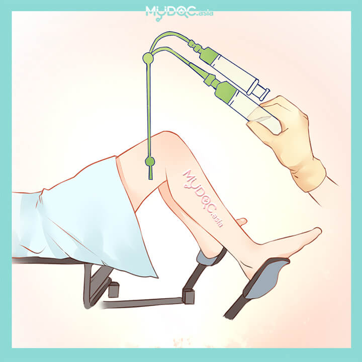 Best Infertility Treatment, Sperm Collection in Pasir Gudang, Johor