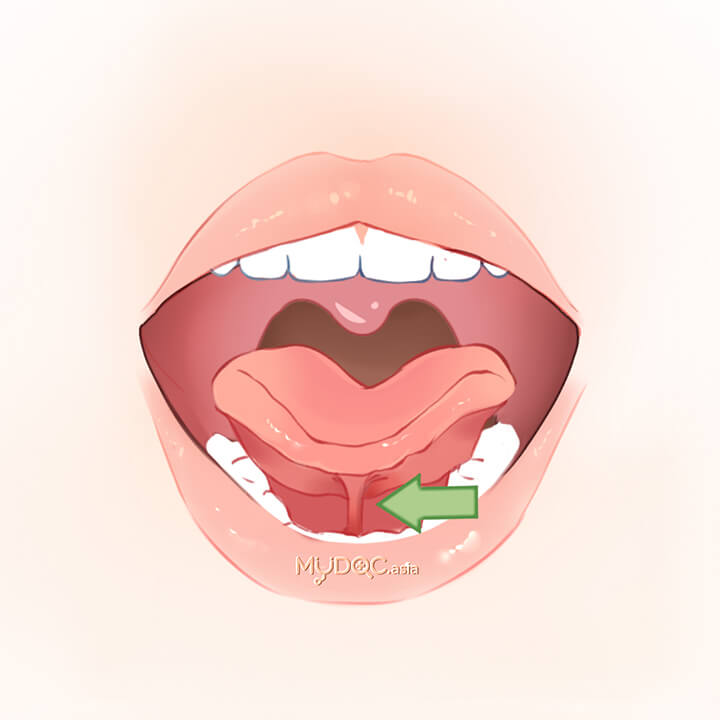 Frenulum Frenulum of