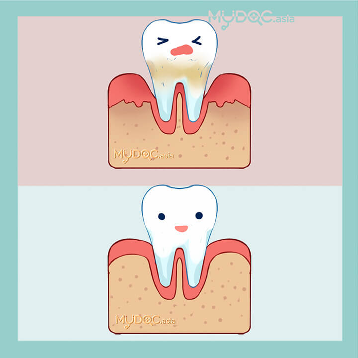 Periodontist Consultation