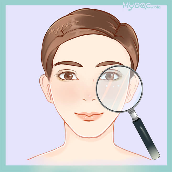 Skin Analysis