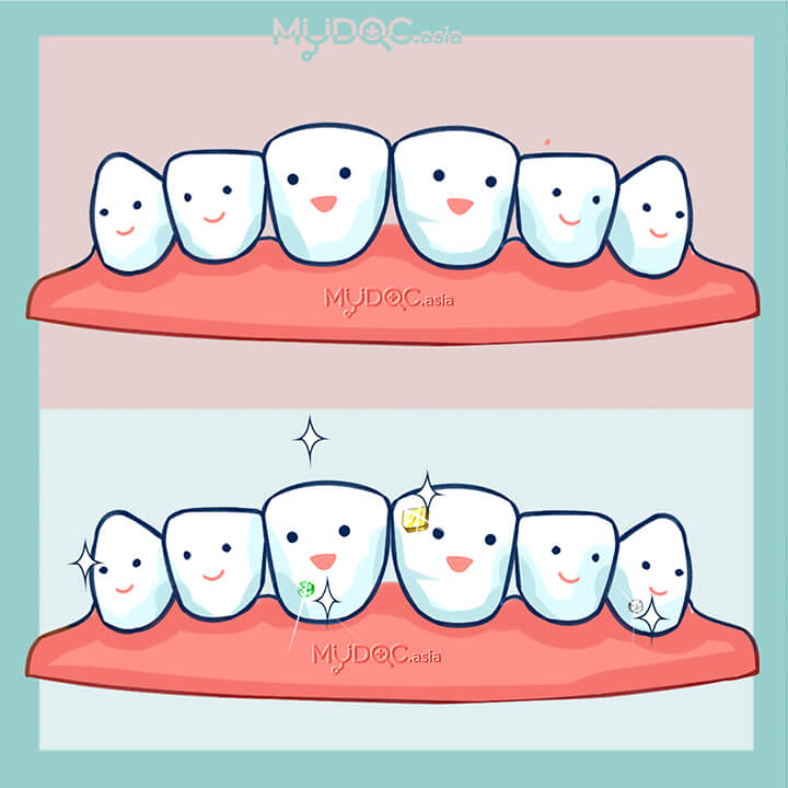 Tooth Jewelry