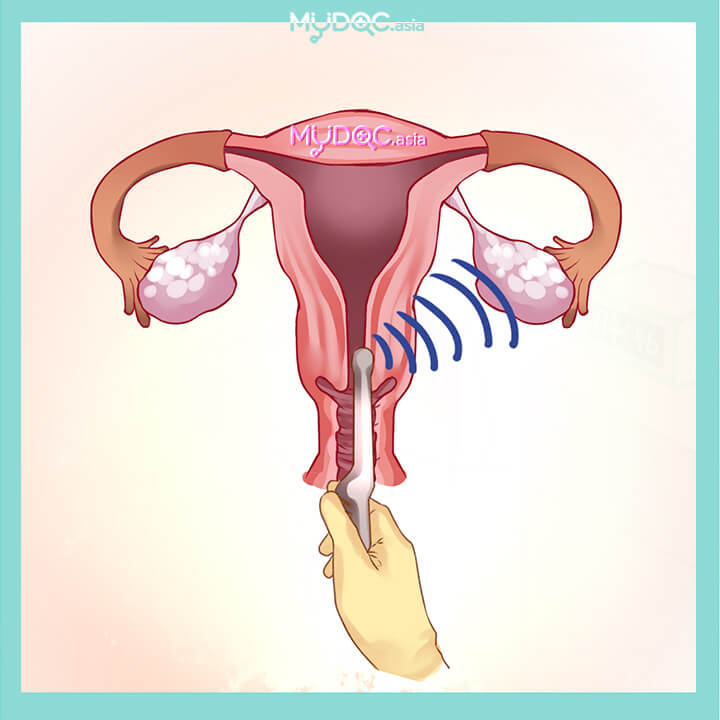 Ommaviy anal fisting video