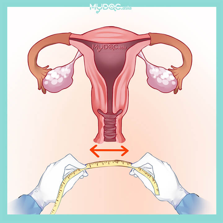 Uterus Measurement